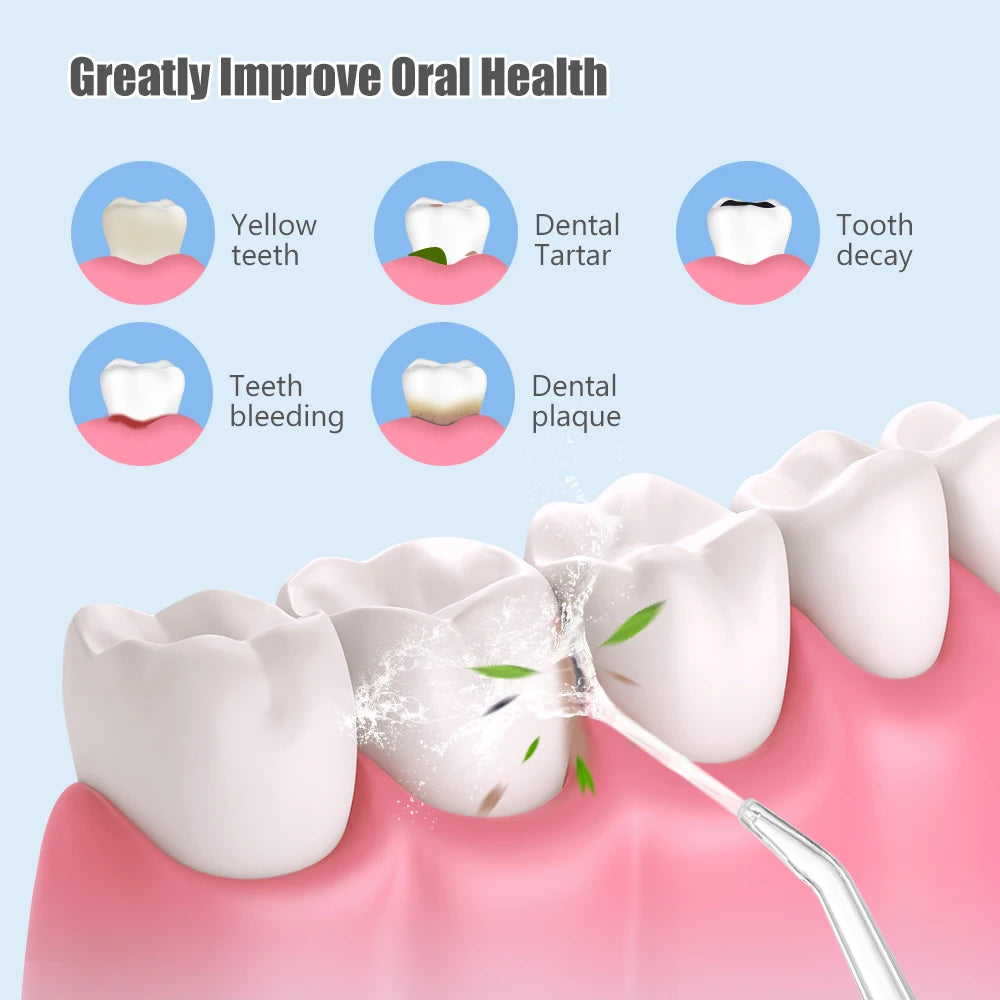 Dental Water Flosser (Oral Irrigator)